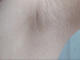 300人の腋 2　サンプル画像02